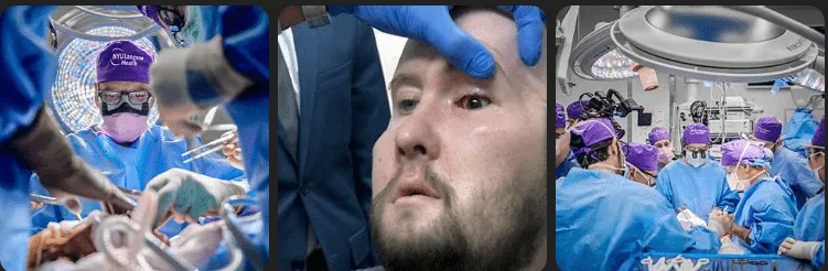 First-Ever Whole Eye Transplant Surgery